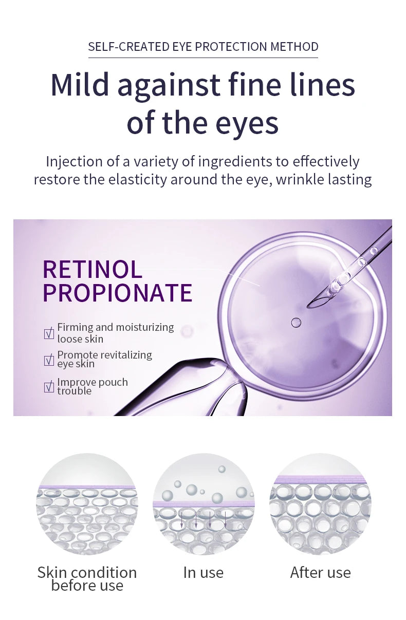 Roller Contour des Yeux — Anti-Cernes & Anti-Rides à l'Acide Hyaluronique 20g