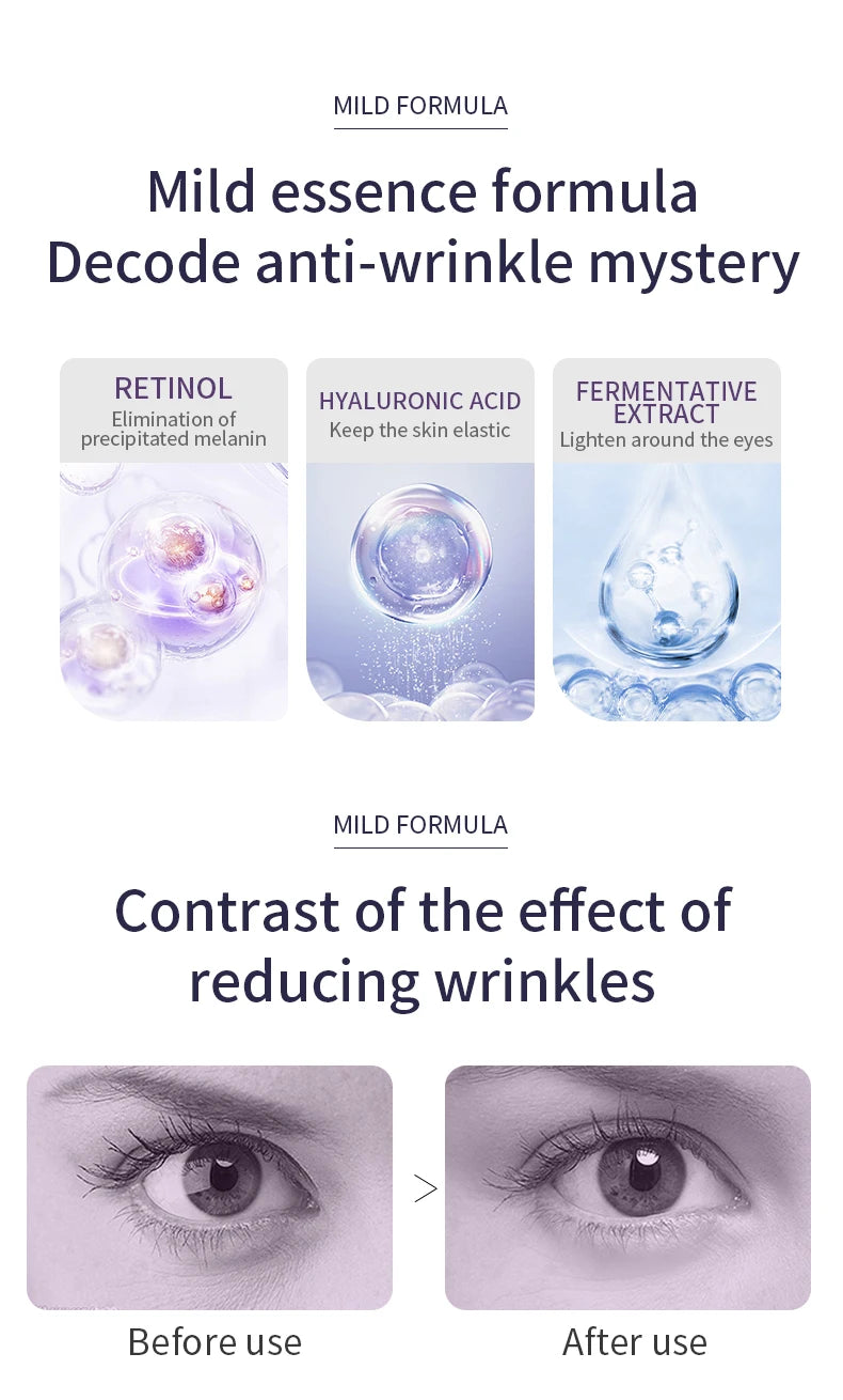 Roller Contour des Yeux — Anti-Cernes & Anti-Rides à l'Acide Hyaluronique 20g